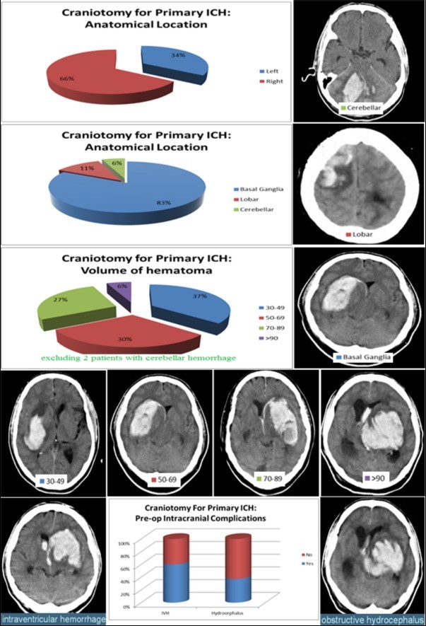 Outcome in Patients with Spontaneous Primary Intracranial Hemorrhage ...