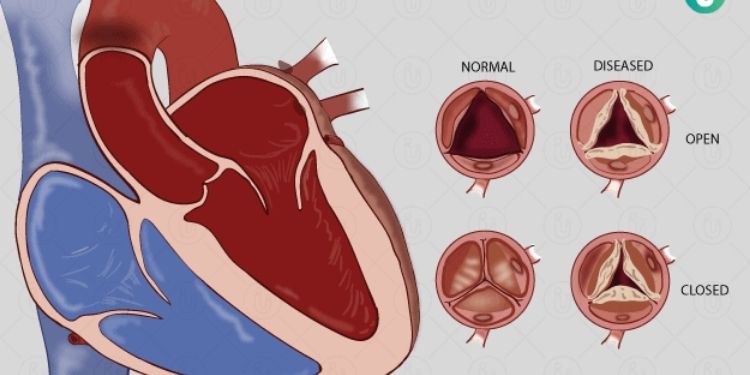 Journal of Hypertension and Cardiology-Heart