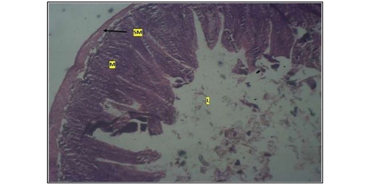 Journal of Public Health International-Large intestine